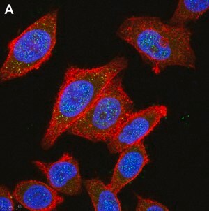 Merck Anti-HDAC4 Antibody, clone 1C16 ZooMAb Rabbit Monoclonal