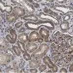 Merck Anti-Insulin Receptor β Antibody, clone 1J16 ZooMAb Rabbit Monoclonal