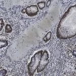 Merck Anti-Phospho-IRF-3-(Ser396) Antibody, clone 2M20 ZooMAb Rabbit Monoclonal