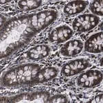 Merck Anti-NME1 Antibody, clone 1H15 ZooMAb Rabbit Monoclonal