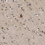 Merck Anti-PKCα Antibody, clone 2H22 ZooMAb Rabbit Monoclonal