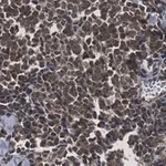 Merck Anti-Myogenin Antibody, clone 1M17 ZooMAb Rabbit Monoclonal
