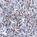 Merck Anti-Cdk4 Antibody, clone 1E19 ZooMAb Rabbit Monoclonal