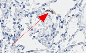 Merck Anti-ACE2-cytoplasmic Antibody, clone 1C17 ZooMAb Rabbit Monoclonal