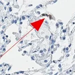 Merck Anti-ACE2-cytoplasmic Antibody, clone 1C17 ZooMAb Rabbit Monoclonal
