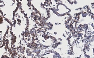 Merck Anti-ACE2-extracellular Antibody, clone 1F21 ZooMAb Rabbit Monoclonal