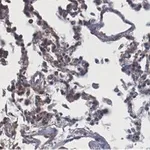 Merck Anti-ACE2-extracellular Antibody, clone 1F21 ZooMAb Rabbit Monoclonal