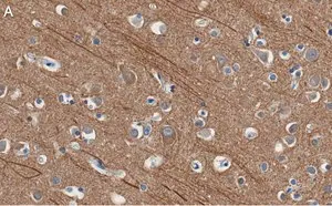 Merck Anti-Presenilin-1 Antibody, clone 2O13 ZooMAb Rabbit Monoclonal