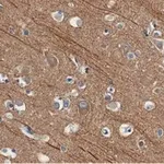 Merck Anti-Presenilin-1 Antibody, clone 2O13 ZooMAb Rabbit Monoclonal