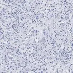 Merck Anti-Integrin αVβ8 Antibody, clone EM13309 , ZooMAb Rabbit Monoclonal