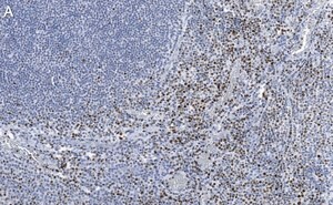 Merck Anti-RUNX2 Antibody, clone 1D6 ZooMAb Rabbit Monoclonal