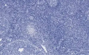 Merck Anti-Ki67 Antibody, clone 1O15, ZooMAb Rabbit Monoclonal