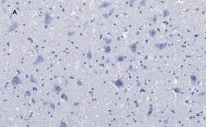 Merck Anti-Choline Acetyltransferase (ChAT) Antibody, clone 2K16, ZooMAb Rabbit Monoclonal
