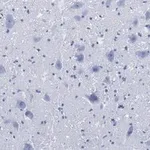 Merck Anti-Choline Acetyltransferase (ChAT) Antibody, clone 2K16, ZooMAb Rabbit Monoclonal
