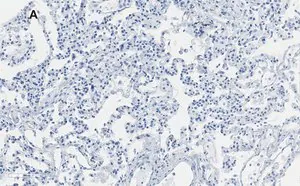 Merck Anti-Integrin alpha V beta 6 Antibody, clone EM05201, ZooMAb Rabbit Monoclonal