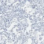 Merck Anti-Integrin alpha V beta 6 Antibody, clone EM05201, ZooMAb Rabbit Monoclonal