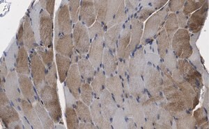 Merck Anti-CACNA2D1 Antibody, clone 1K4 ZooMAb Rabbit Monoclonal