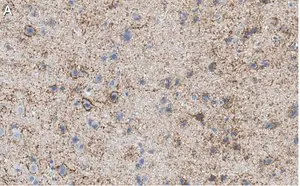 Merck Anti-GAD67 Antibody, clone 1G10.2 ZooMAb Mouse Monoclonal