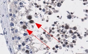 Merck Anti-ATR Antibody, clone 1B15 ZooMAb Rabbit Monoclonal