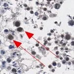 Merck Anti-ATR Antibody, clone 1B15 ZooMAb Rabbit Monoclonal