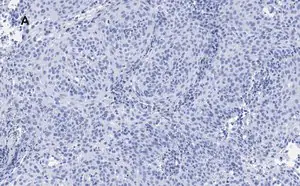 Merck Anti-p21 Antibody, clone 5G7, ZooMAb Rabbit Monoclonal