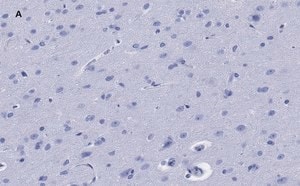 Merck Anti-GFAP Antibody, clone 2E8, ZooMAb Rabbit Monoclonal
