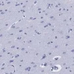 Merck Anti-GFAP Antibody, clone 2E8, ZooMAb Rabbit Monoclonal