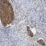 Merck Anti-p16-INK4a Antibody, clone 5F22 Antibody, ZooMAb Rabbit Monoclonal