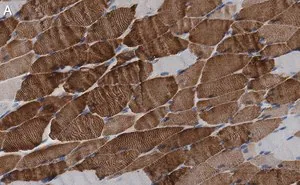 Merck Anti-MYH1 Antibody, clone 1E15 , ZooMAb Rabbit Monoclonal