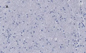 Merck Anti-β-Tubulin III Antibody, clone 5H16, ZooMAb Rabbit Monoclonal