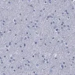 Merck Anti-β-Tubulin III Antibody, clone 5H16, ZooMAb Rabbit Monoclonal