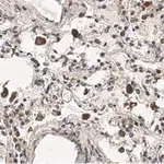 Merck Anti-MRC1 Antibody, clone 1C9 ZooMAb Rabbit Monoclonal