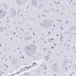 Merck Anti-Tyrosine Hydroxylase Antibody, clone 3M12, ZooMAb Rabbit Monoclonal