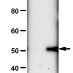 Merck Anti-N3-Phosphohistidine (3-pHis) Antibody, clone SC56-2, ZooMAb Rabbit Monoclonal