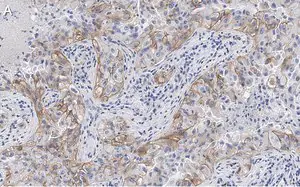 Merck Anti-Integrin αVβ3 Antibody, clone EM22703 ZooMAb Rabbit Monoclonal