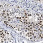 Merck Anti-RAD51 Antibody, clone 1M8 ZooMAb Rabbit Monoclonal