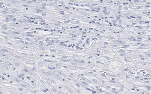 Merck Anti-β-Actin Antibody, clone 6L12, ZooMAb Rabbit Monoclonal