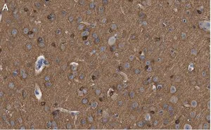 Merck Anti-Tau-1 Antibody, clone PC1C6 ZooMAb Mouse Monoclonal