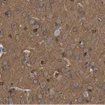 Merck Anti-Tau-1 Antibody, clone PC1C6 ZooMAb Mouse Monoclonal