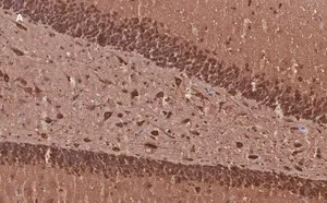 Merck Anti-MAP2 Antibody, clone 3C19, ZooMAb Rabbit Monoclonal