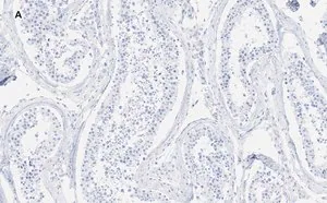 Merck Anti-GAPDH Antibody, clone 10B13, ZooMAb Rabbit Monoclonal