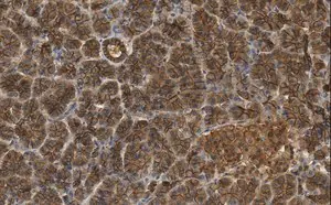 Merck Anti-beta Catenin Antibody, clone 3J7, ZooMAb Rabbit Monoclonal