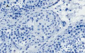 Merck Anti-OCT4 Antibody, clone 4N8, ZooMAb Rabbit Monoclonal