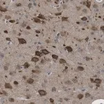 Merck Anti-LC3B Antibody, clone 12K5, ZooMAb Rabbit Monoclonal