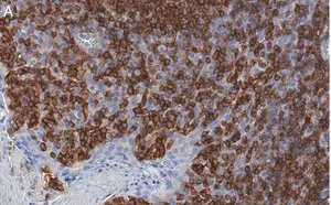 Merck Anti-TIGIT Antibody, clone 1D20 ZooMAb Rabbit Monoclonal