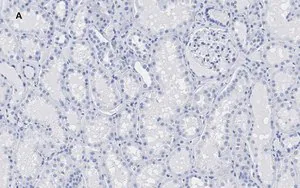 Merck Anti-HMGB1 Antibody, clone 3K6, ZooMAb Rabbit Monoclonal
