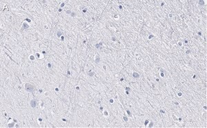 Merck Anti-BLBP/FABP7 Antibody, clone 7I23, ZooMAb Rabbit Monoclonal