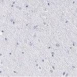 Merck Anti-BLBP/FABP7 Antibody, clone 7I23, ZooMAb Rabbit Monoclonal