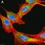 Merck Anti-phospho-IRE-1α (Ser724) Antibody, clone 1M2 ZooMAb Rabbit Monoclonal