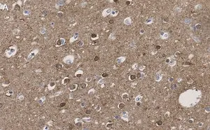 Merck Anti-CRBN Antibody, clone 3I23 ZooMAb Rabbit Monoclonal